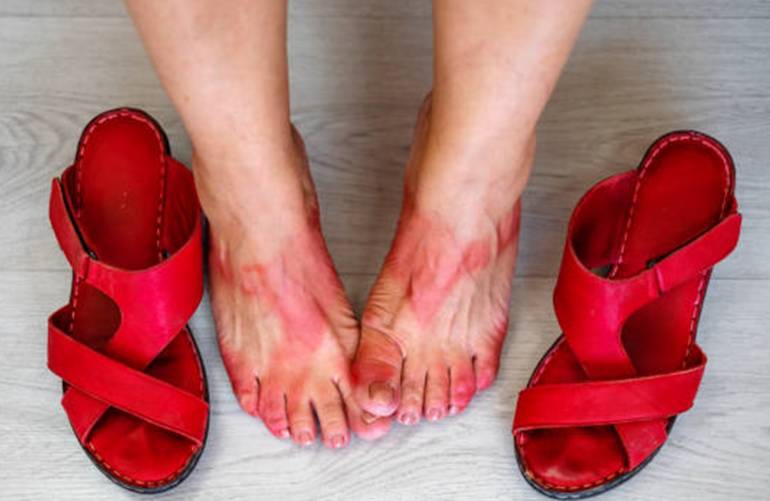 9 astuces contre les chaussures qui déteignent